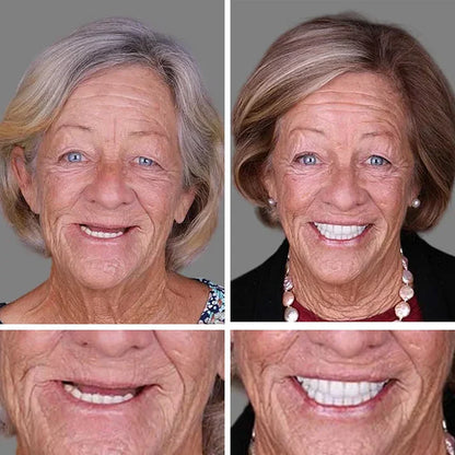 🌎Ends Today: 70% OFF! ⏰ Custom-Fit Full Functional Dentures Make you more confident